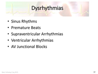 Marc Imhotep Cray, M.D.
Dysrhythmias
37
• Sinus Rhythms
• Premature Beats
• Supraventricular Arrhythmias
• Ventricular Arrhythmias
• AV Junctional Blocks
 