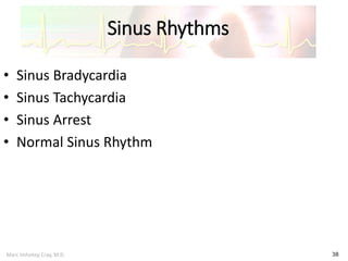 Marc Imhotep Cray, M.D.
Sinus Rhythms
38
• Sinus Bradycardia
• Sinus Tachycardia
• Sinus Arrest
• Normal Sinus Rhythm
 