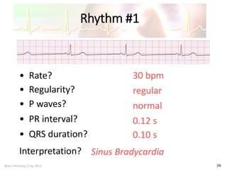 Marc Imhotep Cray, M.D.
Rhythm #1
39
30 bpm• Rate?
• Regularity? regular
normal
0.10 s
• P waves?
• PR interval? 0.12 s
• QRS duration?
Interpretation? Sinus Bradycardia
 