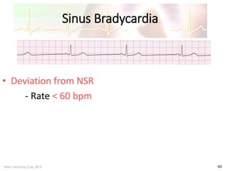 Marc Imhotep Cray, M.D.
Sinus Bradycardia
40
• Deviation from NSR
- Rate < 60 bpm
 