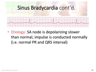 Marc Imhotep Cray, M.D.
Sinus Bradycardia cont’d.
41
• Etiology: SA node is depolarizing slower
than normal, impulse is conducted normally
(i.e. normal PR and QRS interval)
 