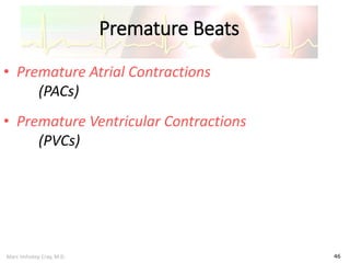 Marc Imhotep Cray, M.D.
Premature Beats
46
• Premature Atrial Contractions
(PACs)
• Premature Ventricular Contractions
(PVCs)
 