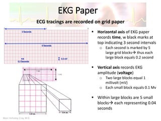 Marc Imhotep Cray, M.D.
EKG Paper
 Horizontal axis of EKG paper
records time, w black marks at
top indicating 3 second intervals
o Each second is marked by 5
large grid blocks thus each
large block equals 0.2 second
 Vertical axis records EKG
amplitude (voltage)
o Two large blocks equal 1
millivolt (mV)
o Each small block equals 0.1 Mv
 Within large blocks are 5 small
blocks each representing 0.04
seconds
ECG tracings are recorded on grid paper
 