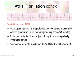 Marc Imhotep Cray, M.D.
Atrial Fibrillation cont’d.
58
• Deviation from NSR
– No organized atrial depolarization so no normal P
waves (impulses are not originating from SA node)
– Atrial activity is chaotic (resulting in an irregularly
irregular rate)
– Common, affects 2-4%, up to 5-10% if > 80 years old
 