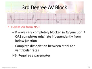Marc Imhotep Cray, M.D.
3rd Degree AV Block
75
• Deviation from NSR
– P waves are completely blocked in AV junction
QRS complexes originate independently from
below junction
– Complete dissociation between atrial and
ventricular rates
NB: Requires a pacemaker
 