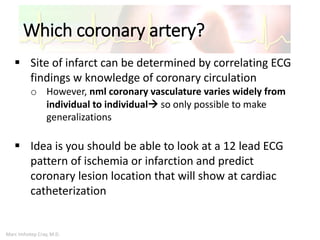Marc Imhotep Cray, M.D.
Which coronary artery?
 Site of infarct can be determined by correlating ECG
findings w knowledge of coronary circulation
o However, nml coronary vasculature varies widely from
individual to individual so only possible to make
generalizations
 Idea is you should be able to look at a 12 lead ECG
pattern of ischemia or infarction and predict
coronary lesion location that will show at cardiac
catheterization
 