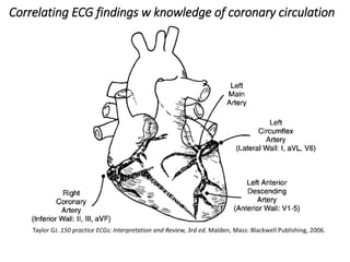 Taylor GJ. 150 practice ECGs: Interpretation and Review, 3rd ed. Malden, Mass: Blackwell Publishing, 2006.
Correlating ECG findings w knowledge of coronary circulation
 