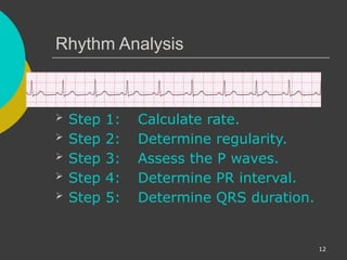 Comprehensive ECG Interpretation and Cardiac Rhythm Analysis Training ...