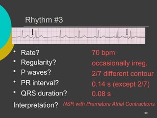 Comprehensive ECG Interpretation and Cardiac Rhythm Analysis Training ...