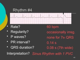 Comprehensive ECG Interpretation and Cardiac Rhythm Analysis Training ...