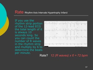 Comprehensive ECG Interpretation and Cardiac Rhythm Analysis Training ...