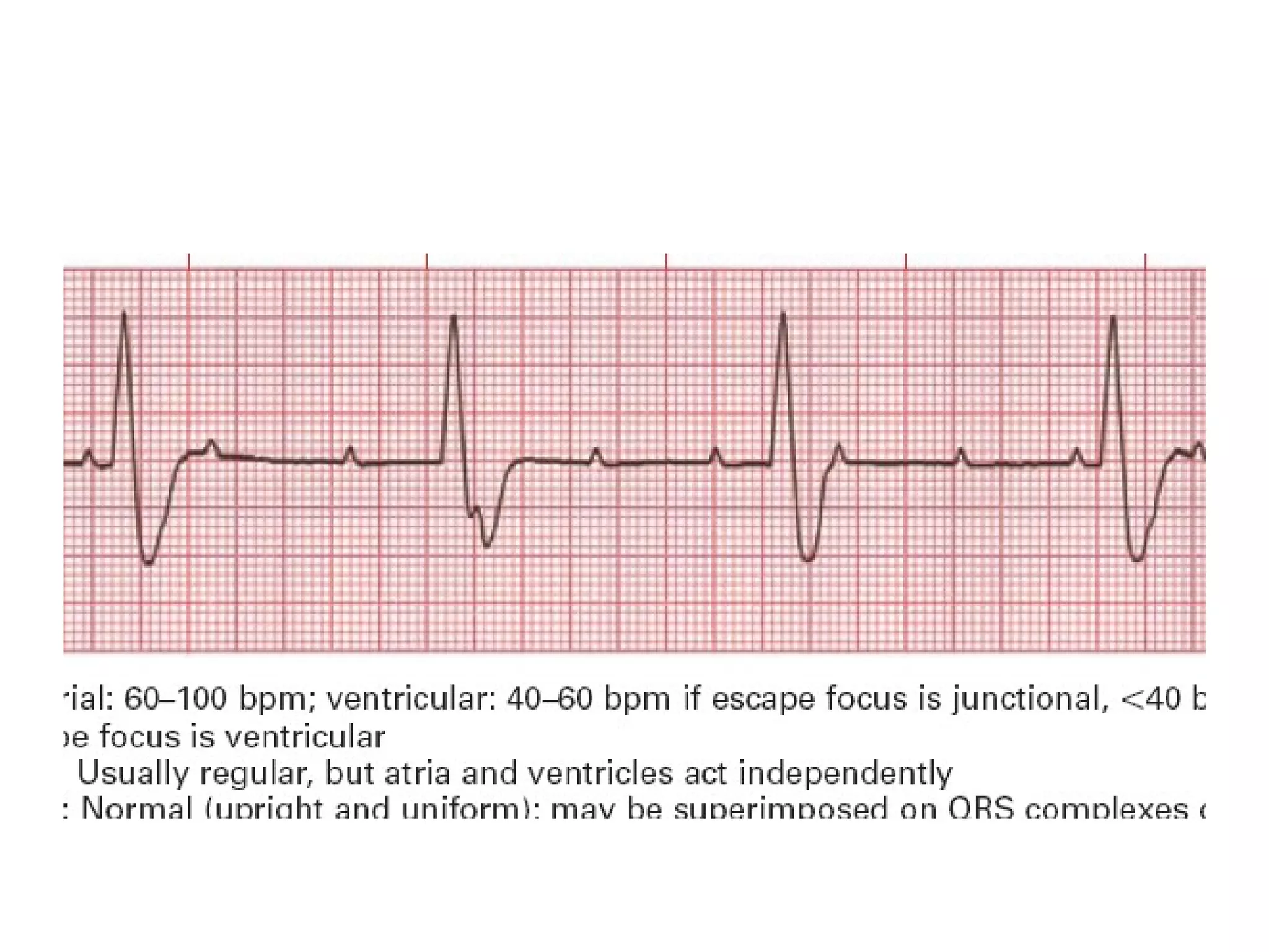 Ecg Interpritation (2) | PPT