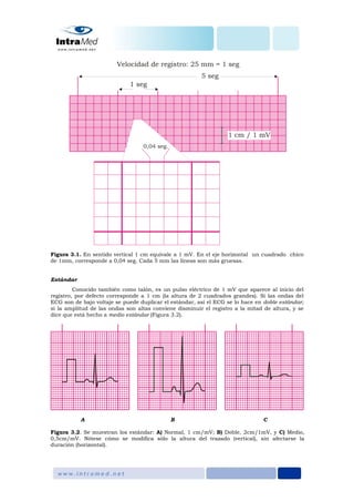 Figura 3.1. En sentido vertical 1 cm equivale a 1 mV. En el eje horizontal un cuadrado chico
de 1mm, corresponde a 0,04 seg. Cada 5 mm las líneas son más gruesas.
Estándar
Conocido también como talón, es un pulso eléctrico de 1 mV que aparece al inicio del
registro, por defecto corresponde a 1 cm (la altura de 2 cuadrados grandes). Si las ondas del
ECG son de bajo voltaje se puede duplicar el estándar, así el ECG se lo hace en doble estándar;
si la amplitud de las ondas son altas conviene disminuir el registro a la mitad de altura, y se
dice que está hecho a medio estándar (Figura 3.2).
A B C
Figura 3.2. Se muestran los estándar: A) Normal, 1 cm/mV; B) Doble, 2cm/1mV, y C) Medio,
0,5cm/mV. Nótese cómo se modifica sólo la altura del trazado (vertical), sin afectarse la
duración (horizontal).
 