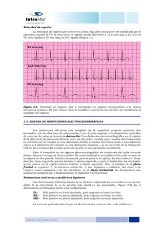 Velocidad de registro
La velocidad de registro por defecto es 25mm/seg, pero ésta puede ser modificada por el
operador; cuando la FC es muy lenta el registro puede hacérselo a 12,5 mm/seg, y en caso de
FC muy rápidas a 50 mm/seg, en FC rápidas (Figura 3.3).
Figura 3.3. Velocidad de registro. Las 3 velocidades de registro corresponden a la misma
frecuencia cardiaca, 80 lpm; nótese cómo se modifica el ancho de los eventos, sin modificarse la
amplitud del registro.
3.3. SISTEMA DE DERIVACIONES ELECTROCARDIOGRÁFICAS
Los potenciales eléctricos son recogidos de la superficie corporal mediante dos
electrodos, uno de ellos hace de polo positivo y otro de polo negativo; a la disposición específica
de cada par de polos se denomina derivación. Una derivación electrocardiográfica es el registro
de la diferencia de potencial eléctrico entre los dos polos; cuando uno o ambos electrodos están
en contacto con el corazón es una derivación directa, si ambos electrodos están a una distancia
mayor a 2 diámetros del corazón es una derivación indirecta, y si un electrodo de la derivación
está en las cercanías del corazón pero sin tocarlo, es una derivación semidirecta.
Para la obtención de un registro electrocardiográfico las terminales del cable paciente
deben colocarse en lugares determinados. De modo habitual la actividad eléctrica del corazón se
la explora en dos planos: frontal y horizontal; para el primero se aplican los electrodos en: brazo
derecho, brazo izquierdo, pierna derecha y pierna izquierda; y para el horizontal, los electrodos
se los ubican en la región torácica anterior y lateral izquierda. Para el análisis en el plano
frontal se registran 6 derivaciones indirectas, 3 son bipolares o estándar, las otras 3 se
conocen como unipolares o de los miembros; en el plano horizontal, las derivaciones son
unipolares semidirectas, y habitualmente se registran 6 derivaciones.
Derivaciones indirectas o periféricas bipolares
Las derivaciones indirectas bipolares se obtienen aplicando los electrodos en la porción
distal de la extremidad (o en la porción más distal en los amputados, Figura 3.3), las 3
derivaciones así formadas tienen esta configuración:
DI - Polo positivo en brazo izquierdo, polo negativo en brazo derecho.
DII - Polo positivo en pierna izquierda, polo negativo en brazo derecho.
DIII - Polo positivo en pierna izquierda, polo negativo en brazo izquierdo.
La terminal aplicada sobre la pierna derecha actúa como un electrodo indiferente.
 