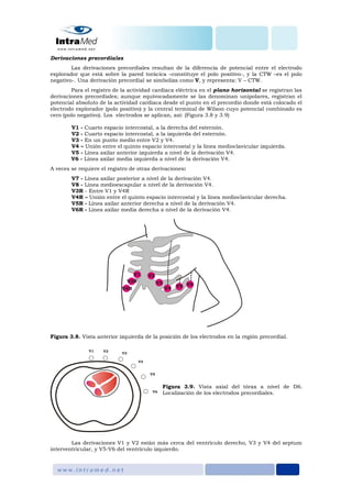 Derivaciones precordiales
Las derivaciones precordiales resultan de la diferencia de potencial entre el electrodo
explorador que está sobre la pared torácica –constituye el polo positivo-, y la CTW –es el polo
negativo-. Una derivación precordial se simboliza como V, y representa: V – CTW.
Para el registro de la actividad cardiaca eléctrica en el plano horizontal se registran las
derivaciones precordiales; aunque equivocadamente se las denominan unipolares, registran el
potencial absoluto de la actividad cardiaca desde el punto en el precordio donde está colocado el
electrodo explorador (polo positivo) y la central terminal de Wilson cuyo potencial combinado es
cero (polo negativo). Los electrodos se aplican, así: (Figura 3.8 y 3.9)
V1 - Cuarto espacio intercostal, a la derecha del esternón.
V2 - Cuarto espacio intercostal, a la izquierda del esternón.
V3 - En un punto medio entre V2 y V4.
V4 – Unión entre el quinto espacio intercostal y la línea medioclavicular izquierda.
V5 - Línea axilar anterior izquierda a nivel de la derivación V4.
V6 - Línea axilar media izquierda a nivel de la derivación V4.
A veces se requiere el registro de otras derivaciones:
V7 - Línea axilar posterior a nivel de la derivación V4.
V8 - Línea medioescapular a nivel de la derivación V4.
V3R - Entre V1 y V4R
V4R – Unión entre el quinto espacio intercostal y la línea medioclavicular derecha.
V5R - Línea axilar anterior derecha a nivel de la derivación V4.
V6R - Línea axilar media derecha a nivel de la derivación V4.
Figura 3.8. Vista anterior izquierda de la posición de los electrodos en la región precordial.
Figura 3.9. Vista axial del tórax a nivel de D6.
Localización de los electrodos precordiales.
Las derivaciones V1 y V2 están más cerca del ventrículo derecho, V3 y V4 del septum
interventricular, y V5-V6 del ventrículo izquierdo.
 
