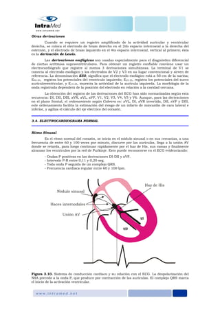 Otras derivaciones
Cuando se requiere un registro amplificado de la actividad auricular y ventricular
derecha, se coloca el electrodo de brazo derecho en el 2do espacio intercostal a la derecha del
esternón, y el electrodo de brazo izquierdo en el 4to espacio intercostal, vertical al primero; ésta
es la derivación de Lewis.
Las derivaciones esofágicas son usadas especialmente para el diagnóstico diferencial
de ciertas arritmias supraventriculares. Para obtener un registro confiable conviene usar un
electrocardiógrafo que registre al menos 3 derivaciones simultáneas. La terminal de V1 se
conecta al electrodo esofágico y los electrodos de V2 y V3 en su lugar convencional y sirven de
referencia. La denominación E50, significa que el electrodo esofágico está a 50 cm de la narina;
E40-50, registra los potenciales del ventrículo izquierdo; E25-35, registra los potenciales del surco
aurículoventricular, y E15-25, muestra la actividad de la aurícula izquierda. La morfología de la
onda registrada dependerá de la posición del electrodo en relación a la cavidad cercana.
La obtención del registro de las derivaciones del ECG han sido normatizadas según esta
secuencia: DI, DII, DIII, aVR, aVL, aVF, V1, V2, V3, V4, V5 y V6. Aunque, para las derivaciones
en el plano frontal, el ordenamiento según Cabrera es: aVL, DI, aVR invertida, DII, aVF y DIII,
este ordenamiento facilita la estimación del riesgo de un infarto de miocardio de cara lateral e
inferior, y agiliza el cálculo del eje eléctrico del corazón.
3.4. ELECTROCARDIOGRAMA NORMAL
Ritmo Sinusal
Es el ritmo normal del corazón, se inicia en el nódulo sinusal o en sus cercanías, a una
frecuencia de entre 60 y 100 veces por minuto, discurre por las aurículas, llega a la unión AV
donde se retarda, para luego continuar rápidamente por el haz de His, sus ramas y finalmente
alcanzar los ventrículos por la red de Purkinje. Esto puede reconocerse en el ECG evidenciando:
- Ondas P positivas en las derivaciones DI-DII y aVF.
- Intervalo P-R entre 0,11 y 0,20 seg.
- Toda onda P seguida de un complejo QRS.
- Frecuencia cardiaca regular entre 60 y 100 lpm.
Figura 3.10. Sistema de conducción cardiaco y su relación con el ECG. La despolarización del
NSA precede a la onda P, que produce por contracción de las aurículas. El complejo QRS marca
el inicio de la activación ventricular.
 