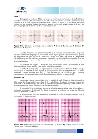 Onda P
Es la primera onda del ECG, representa la contracción aurículas, es la deflexión que
precede al complejo QRS, es positiva en DI, DII, aVF y precordiales izquierdas, bifásica en V1 y
negativa en aVR; tiene una duración entre 0,06 y 0,11 seg, su altura <2,5 mm, es de morfología
roma o con una pequeña muesca. La primera porción corresponde a la activación de la aurícula
derecha y la porción terminal a la de la aurícula izquierda.
A B C D E
Figura 3.13. Diferentes morfologías de la onda P. A. Normal, B. Bimodal, C. Bifásica, D.
Acuminada, E. Negativa.
La onda P negativa sólo es normal en aVR y en pacientes con dextrocardia, si aparece
en otras derivaciones es porque la contracción no se origina por un impulso sinusal, o porque
los electrodos de los miembros superiores están invertidos. La onda P acuminada,
particularmente en DII, suele corresponder a patologías con agrandamiento auricular derecho,
en tanto que la onda P bimodal y con aumento en su duración, corresponde a crecimiento
auricular izquierdo.
La ausencia de ondas P (segmento T-R isoeléctrico), puede corresponder a una
hiperkalemia o a ritmos nacidos en la unión aurículo-ventricular.
La onda Ta corresponde a la repolarización auricular; es una deflexión de bajo voltaje,
su polaridad es oponente a la de la onda P, la sumatoria del área de ambas es cero, y es mejor
observada cuando coexiste con BAV I°. Su duración es de 0,22-0,38 seg y aunque
habitualmente sólo ocupa el segmento P-R puede extenderse hasta el segmento ST.
Intervalo P-R
Involucra el espacio comprendido entre el inicio de la onda P hasta el inicio del complejo
QRS (onda Q o R), es isoeléctrico y dura de 0,11 a 0,20 seg. Refleja del tiempo de conducción
auricular, el retardo fisiológico en la UAV y la conducción en el His-Purkinje. Normalmente, su
duración disminuye con el aumento de la frecuencia cardiaca.
El intervalo P-R corto puede ser normal, y se lo observa asociado a onda Delta en la pre-
excitación ventricular. El intervalo P-R largo permanente y uniforme es propio del bloqueo
aurículo ventricular I° (BAV I°).
El supradesnivel sutil del segmento P-R aparece en casos de infarto auricular y en la
pericarditis en fase temprana.
Figura 3.14. Diferentes duraciones del intervalo PR. A) Normal. B) Corto y asociado a onda
Delta y onda T negativa. C) Largo.
 