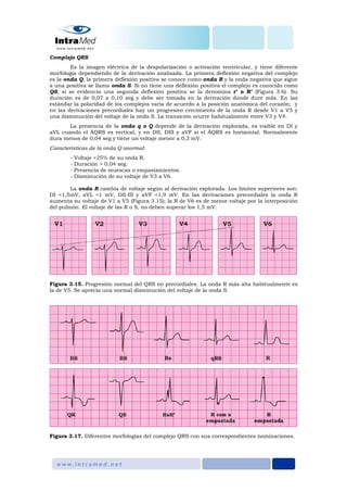 Complejo QRS
Es la imagen eléctrica de la despolarización o activación ventricular, y tiene diferente
morfología dependiendo de la derivación analizada. La primera deflexión negativa del complejo
es la onda Q, la primera deflexión positiva se conoce como onda R y la onda negativa que sigue
a una positiva se llama onda S. Si no tiene una deflexión positiva el complejo es conocido como
QS, si se evidencia una segunda deflexión positiva se la denomina r’ o R’ (Figura 3.6). Su
duración es de 0,07 a 0,10 seg y debe ser tomada en la derivación donde dure más. En las
estándar la polaridad de los complejos varía de acuerdo a la posición anatómica del corazón; y
en las derivaciones precordiales hay un progresivo crecimiento de la onda R desde V1 a V5 y
una disminución del voltaje de la onda S. La transición ocurre habitualmente entre V3 y V4.
La presencia de la onda q o Q depende de la derivación explorada, es visible en DI y
aVL cuando el ÂQRS es vertical, y en DII, DIII y aVF si el ÂQRS es horizontal. Normalmente
dura menos de 0,04 seg y tiene un voltaje menor a 0,3 mV.
Características de la onda Q anormal:
- Voltaje >25% de su onda R.
- Duración > 0,04 seg.
- Presencia de muescas o empastamientos.
- Disminución de su voltaje de V3 a V6.
La onda R cambia de voltaje según al derivación explorada. Los límites superiores son:
DI <1,5mV, aVL <1 mV, DII-III y aVF <1,9 mV. En las derivaciones precordiales la onda R
aumenta su voltaje de V1 a V5 (Figura 3.15); la R de V6 es de menor voltaje por la interposición
del pulmón. El voltaje de las R o S, no deben superar los 1,5 mV.
Figura 3.15. Progresión normal del QRS en precordiales. La onda R más alta habitualmente es
la de V5. Se aprecia una normal disminución del voltaje de la onda S.
Figura 3.17. Diferentes morfologías del complejo QRS con sus correspondientes nominaciones.
 