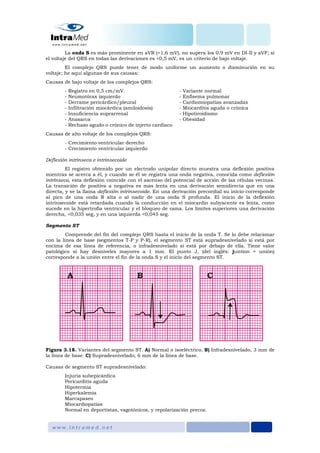 La onda S es más prominente en aVR (<1,6 mV), no supera los 0,9 mV en DI-II y aVF; si
el voltaje del QRS en todas las derivaciones es <0,5 mV, es un criterio de bajo voltaje.
El complejo QRS puede tener de modo uniforme un aumento o disminución en su
voltaje; he aquí algunas de sus causas:
Causas de bajo voltaje de los complejos QRS:
- Registro en 0,5 cm/mV. - Variante normal
- Neumotórax izquierdo - Enfisema pulmonar
- Derrame pericárdico/pleural - Cardiomiopatías avanzadas
- Infiltración miocárdica (amiloidosis) - Miocarditis aguda o crónica
- Insuficiencia suprarrenal - Hipotiroidismo
- Anasarca - Obesidad
- Rechazo agudo o crónico de injerto cardiaco
Causas de alto voltaje de los complejos QRS:
- Crecimiento ventricular derecho
- Crecimiento ventricular izquierdo
Deflexión intrínseca e intrinsecoide
El registro obtenido por un electrodo unipolar directo muestra una deflexión positiva
mientras se acerca a él, y cuando se él se registra una onda negativa, conocida como deflexión
intrínseca, esta deflexión coincide con el ascenso del potencial de acción de las células vecinas.
La transición de positiva a negativa es mas lenta en una derivación semidirecta que en una
directa, y se la llama deflexión intrinsecoide. En una derivación precordial su inicio corresponde
al pico de una onda R alta o al nadir de una onda S profunda. El inicio de la deflexión
intrinsecoide está retardada cuando la conducción en el miocardio subyacente es lenta, como
sucede en la hipertrofia ventricular y el bloqueo de rama. Los límites superiores una derivación
derecha, <0,035 seg, y en una izquierda <0,045 seg.
Segmento ST
Comprende del fin del complejo QRS hasta el inicio de la onda T. Se lo debe relacionar
con la línea de base (segmentos T-P y P-R), el segmento ST está supradesnivelado si está por
encima de esa línea de referencia, o infradesnivelado si está por debajo de ella. Tiene valor
patológico si hay desniveles mayores a 1 mm. El punto J, (del inglés: juntion = unión)
corresponde a la unión entre el fin de la onda S y el inicio del segmento ST.
Figura 3.18. Variantes del segmento ST. A) Normal o isoeléctrico, B) Infradesnivelado, 3 mm de
la línea de base. C) Supradesnivelado, 6 mm de la línea de base.
Causas de segmento ST supradesnivelado:
Injuria subepicárdica
Pericarditis aguda
Hipotermia
Hiperkalemia
Marcapaseo
Miocardiopatías
Normal en deportistas, vagotónicos, y repolarización precoz.
 