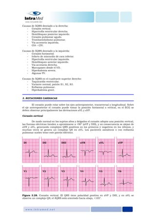 Causas de ÂQRS desviado a la derecha:
- Corazón vertical.
- Hipertrofia ventricular derecha.
- Hemibloqueo posterior izquierdo.
- Corazón pulmonar agudo.
- Tromboembolismo pulmonar.
- Vía accesoria izquierda.
- CIA – CIV.
Causas de ÂQRS desviado a la izquierda:
- Corazón horizontal.
- Infarto de miocardio de cara inferior.
- Hipertrofia ventricular izquierda.
- Hemibloqueo anterior izquierdo.
- Vía accesoria derecha.
- Marcapaseo desde el VD.
- Hiperkalemia severa.
- Algunas TV.
Causas de ÂQRS en el cuadrante superior derecho:
- Taquicardia ventricular.
- Variante normal, patrón S1, S2, S3.
- Enfisema pulmonar.
- Hiperkalemia grave.
3. ROTACIONES CARDIACAS
El corazón puede rotar sobre los ejes anteroposterior, transeversal y longitudinal. Sobre
el eje anteroposterior el corazón puede tomar la posición horizontal o vertical, en el ECG se
deben observar principalmente las derivaciones aVL y aVF.
Corazón vertical
De modo normal en los sujetos altos y delgados el corazón adopta una posición vertical,
las fuerzas eléctricas tienden a aproximarse a +90° (aVF y DIII), y en consecuencia se alejan de
aVR y aVL, generando complejos QRS positivos en los primeros y negativos en los últimos, y
muchas veces se genera un complejo QS en aVL. Los pacientes asmáticos o con enfisema
pulmonar suelen tener este patrón eléctrico.
Figura 3.28. Corazón vertical. El QRS tiene polaridad positiva en aVF y DIII, y en aVL se
observa un complejo QS; el ÂQRS está orientado hacia abajo, +105°.
 