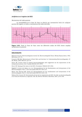 Artificios en el registro del ECG
Movimientos del cable paciente
La inestabilidad de la línea de base se detecta por movimientos lento de cualquier
porción del registro, se debe a movimientos del cable-electrodo.
Figura 3.35. Tanto la línea de base como las diferentes ondas del ECG tienen amplias
oscilaciones de posición
BIBLIOGRAFÍA
Bayés de Luna AJ. Electrocardiograma normal. En: Electrocardiografía Clínica. Mosby/Doyma Libros, 1992,
Barcelona, p 31-76.
Connover MB (Ed). Measurement of Heart Rate and Intervals. In: Understanding Electrocardiography, 8th
Ed, Mosby, 2006, Missouri, p41-44.
Hurst JW. Current status of clinical electrocardiography with suggestions for the improvement of the
interpretative process. Am J Cardiol 2003;92:1072-1079.
Hurst JW. Naming of the waves in the ECG. Circulation 1998;98:1937-1942.
Kligfield P, Gettes LS, Bailey JJ, et al. Recomendations for the Standarization and Interpretation of the
Electrocardiogram. Part I. J Am Coll Cardiol 2007;49:1109-1127.
Mason JW, Hancock EW, Gettes LS. Recomendations for the standarization and interpretation of the
electrocardiogram. Part II. J Am Coll Cardiol 2007;49:1128-1135.
Wellens HJJ, Conover M. Determinación del eje de los componentes del ECG. En: Eds. La electrocardiografía
en la toma de decisiones en urgencias. 2da. Ed, Elsevier Saunders. Barcelona. 2007, p 251-258.
 