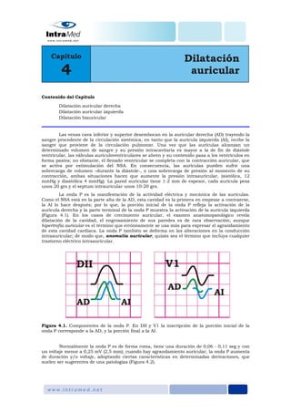 Contenido del Capítulo
Dilatación auricular derecha
Dilatación auricular izquierda
Dilatación biauricular
Las venas cava inferior y superior desembocan en la auricular derecha (AD) trayendo la
sangre procedente de la circulación sistémica, en tanto que la aurícula izquierda (AI), recibe la
sangre que proviene de la circulación pulmonar. Una vez que las aurículas alcanzan un
determinado volumen de sangre y su presión intracavitaria es mayor a la de fin de diástole
ventricular, las válvulas auriculoventriculares se abren y su contenido pasa a los ventrículos en
forma pasiva; no obstante, el llenado ventricular se completa con la contracción auricular, que
se activa por estimulación del NSA. En consecuencia, las aurículas pueden sufrir una
sobrecarga de volumen –durante la diástole-, o una sobrecarga de presión al momento de su
contracción, ambas situaciones hacen que aumente la presión intraauricular, (sistólica, 12
mmHg y diastólica 4 mmHg). La pared auricular tiene 1-2 mm de espesor, cada aurícula pesa
unos 20 grs y el septum intrauricular unos 10-20 grs.
La onda P es la manifestación de la actividad eléctrica y mecánica de las aurículas.
Como el NSA está en la parte alta de la AD, esta cavidad es la primera en empezar a contraerse,
la AI lo hace después; por lo que, la porción inicial de la onda P refleja la activación de la
aurícula derecha y la parte terminal de la onda P muestra la activación de la aurícula izquierda
(Figura 4.1). En los casos de crecimiento auricular, el examen anatomopatológico revela
dilatación de la cavidad, el engrosamiento de sus paredes es de rara observación; aunque
hipertrofia auricular es el término que erróneamente se usa más para expresar el agrandamiento
de esta cavidad cardiaca. La onda P también se deforma en las alteraciones en la conducción
intraauricular; de modo que, anomalía auricular, quizás sea el término que incluya cualquier
trastorno eléctrico intraauricular.
Figura 4.1. Componentes de la onda P. En DII y V1 la inscripción de la porción inicial de la
onda P corresponde a la AD, y la porción final a la AI.
Normalmente la onda P es de forma roma, tiene una duración de 0,06 - 0,11 seg y con
un voltaje menor a 0,25 mV (2,5 mm); cuando hay agrandamiento auricular, la onda P aumenta
de duración y/o voltaje, adoptando ciertas características en determinadas derivaciones, que
suelen ser sugerentes de una patologías (Figura 4.2).
 