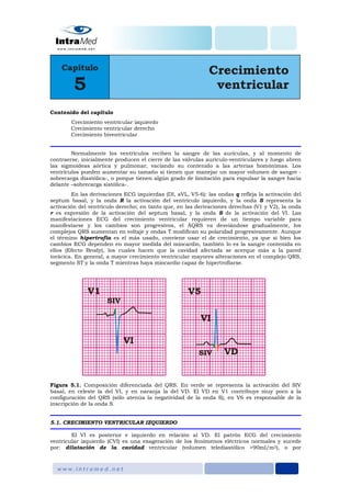 Contenido del capítulo
Crecimiento ventricular izquierdo
Crecimiento ventricular derecho
Crecimiento biventricular
Normalmente los ventrículos reciben la sangre de las aurículas, y al momento de
contraerse, inicialmente producen el cierre de las válvulas aurículo-ventriculares y luego abren
las sigmoideas aórtica y pulmonar, vaciando su contenido a las arterias homónimas. Los
ventrículos pueden aumentar su tamaño si tienen que manejar un mayor volumen de sangre -
sobrecarga diastólica-, o porque tienen algún grado de limitación para expulsar la sangre hacia
delante –sobrecarga sistólica-.
En las derivaciones ECG izquierdas (DI, aVL, V5-6): las ondas q refleja la activación del
septum basal, y la onda R la activación del ventrículo izquierdo, y la onda S representa la
activación del ventrículo derecho; en tanto que, en las derivaciones derechas (V1 y V2), la onda
r es expresión de la activación del septum basal, y la onda S de la activación del VI. Las
manifestaciones ECG del crecimiento ventricular requieren de un tiempo variable para
manifestarse y los cambios son progresivos, el ÂQRS va desviándose gradualmente, los
complejos QRS aumentan en voltaje y ondas T modifican su polaridad progresivamente. Aunque
el término hipertrofia es el más usado, conviene usar el de crecimiento, ya que si bien los
cambios ECG dependen en mayor medida del miocardio, también lo es la sangre contenida en
ellos (Efecto Brody), los cuales hacen que la cavidad afectada se acerque más a la pared
torácica. En general, a mayor crecimiento ventricular mayores alteraciones en el complejo QRS,
segmento ST y la onda T mientras haya miocardio capaz de hipertrofiarse.
Figura 5.1. Composición diferenciada del QRS. En verde se representa la activación del SIV
basal, en celeste la del VI, y en naranja la del VD. El VD en V1 contribuye muy poco a la
configuración del QRS (sólo atenúa la negatividad de la onda S), en V6 es responsable de la
inscripción de la onda S.
5.1. CRECIMIENTO VENTRICULAR IZQUIERDO
El VI es posterior e izquierdo en relación al VD. El patrón ECG del crecimiento
ventricular izquierdo (CVI) es una exageración de los fenómenos eléctricos normales y sucede
por: dilatación de la cavidad ventricular (volumen telediastólico >90ml/m2), o por
 