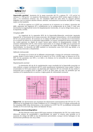 hipertrofia parietal (aumento de la masa muscular del VI y septum IV: >131 gr/m2 en
varones, y >108 gr/m2 en mujeres). Normalmente, los patrones ECG varían según la edad, el
sexo, y la contextura torácica; así, los complejos QRS son más altos en varones jóvenes
delgados, que en mujeres adultas obesas; además, normalmente la duración del QRS es 7 mseg
mayor en los hombres.
El CVI se expresa en el ECG por aumento en el aumento en el voltaje y duración del
QRS, depresión del segmento ST y modificación en la configuración de la onda T; todo esto
incrementa la magnitud del vector de despolarización ventricular, el cual se dirige hacia atrás, a
la izquierda y arriba.
Complejos QRS
La magnitud de la expresión ECG de la hipertrofia/dilatación ventricular izquierda
depende de: el incremento de la masa muscular, del volumen intracavitario, y de la proximidad
del VI a la pared torácica. El aumento en el voltaje del QRS está en relación con el incremento
en el número de fibras en el miocardio hipertrofiado y la mayor cantidad de discos intercalares,
los cuales generan un dipolo de mayor fuerza para inducir la despolarización celular. El
volumen telediastólico del VI, tiene menos repercusión en el voltaje del QRS que el aumento de
la masa muscular, y en parte es por el reemplazo con tejido fibrótico en los VI dilatados no
hipertrofiados. La duración del QRS también se incrementa unos 0,01-0,02 seg debido a la
mayor masa muscular a despolarizar.
Deflexión intrinsecoide
El retraso en el inicio de la deflexión intrinsecoide o tiempo de activación ventricular -
medido desde el inicio hasta el zenit de la onda R, en V5-6, (>0,045 seg), se observa en el 35-
90% de los pacientes con HVI, y se debe a la demora en la activación de masa muscular
hipertrofiada del VI.
Repolarización anormal
La desviación del eje de la repolarización como resultado de la hipertrofia muscular es
más evidente a mayor crecimiento del VI; suele manifestarse inicialmente como ondas T altas y
acuminadas en V5-6 para pasar a la depresión del segmento ST con inversión de las ondas T,
motivando que el ángulo entre el QRS y el ST-T se abra cada vez más. Es probable que los
cambios en la repolarización se asocien a algún grado de enfermedad coronaria.
Figura 5.2. Las derivaciones que muestran las alteraciones características del CVI son V1 y V5.
Obsérvese la morfología de la onda P (bifásica en V1 y bimodal en V5) y el voltaje aumentado de
los complejos QRS estas derivaciones, y los cambios en el ST-T de V5. La deflexión intrisecoide
medida en V5 es de 0,05 seg. Indice de Sokolow 40 mm.
Hallazgos electrocardiográficos
Se han descrito varios signos ECG para sostener el diagnóstico de CVI, los cuales tienen
diferentes valores de sensibilidad y especificidad; de todos, el criterio más sensible es el
aumento de voltaje del QRS en las derivaciones precordiales, aunque ciertos hallazgos en las
derivaciones periféricas son muy útiles.
 