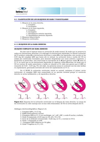 6.1. CLASIFICACIÓN DE LOS BLOQUEOS DE RAMA Y FASCICULARES
1. Bloqueo en la rama derecha.
a. Completo
b. Incompleto
2. Bloqueo en la rama izquierda.
a. Completo
b. Incompleto
c- Hemibloqueo anterior izquierdo
d- Hemibloqueo posterior izquierdo
3. Bloqueos bifasciculares.
4. Bloqueos combinados.
6. 2. BLOQUEOS EN LA RAMA DERECHA
BLOQUEO COMPLETO DE RAMA DERECHA
En este caso el septum inicia su activación de modo normal, de modo que se preserva la
onda r en derivaciones derechas y la onda q en la derivaciones izquierdas; la ulterior activación
del VI produce ondas S en derivaciones derechas y ondas R en las izquierdas, esto sucede en los
0,04 seg del complejo QRS que hasta ahí es normal. La activación lenta y tardía del VD se
realiza por conducción transeptal, para alcanzar despolarizar sus caras anterior y posterior, y
finalmente la pared libre, esto interrumpe la inscripción de la S para generar ondas R’ altas en
V1-2, en tanto que en las derivaciones izquierdas se registran ondas S anchas; de modo que el
VD se contrae de modo asincrónico y tardío en relación al VI, todo esto genera que el QRS se
ensanche de 0,03 – 0,04 seg. Por otro lado, las primeras zonas en activarse son las más tardías
en repolarizarse, generando inversión del vector de repolarización en V1-2.
En el BCRD la activación ventricular inicial es normal, asimismo el primer vector
ventricular; el complejo QRS está ensanchado en su porción terminal porque el ventrículo
derecho se activa tardíamente, y de izquierda a derecha.
Figura 6.2. Esquema de la activación ventricular en el bloqueo de rama derecha. La zonas de
los ventrículos en color naranja aún no han sido estimuladas. El VD se activa después del VI.
Hallazgos electrocardiográficos: (Figura 6.3)
1. Complejo QRS > 0,12 seg.
2. ÂQRS habitualmente normal.
3. Complejos QRS en V1-2 con morfología: rsr’, rsR’, rSR’, u onda R ancha y mellada.
4. Onda S empastada (>0,04 seg.) en DI, aVL, V5 y V6.
5. Inicio de la deflexión intrinsecoide: >0,06 seg. en V1, y normal en V5-6.
6. Onda r’ empastada en aVR.
7.- Complejos QRS trifásicos en V6 (qRs)
8. Onda T negativa en V1 y V2.
 