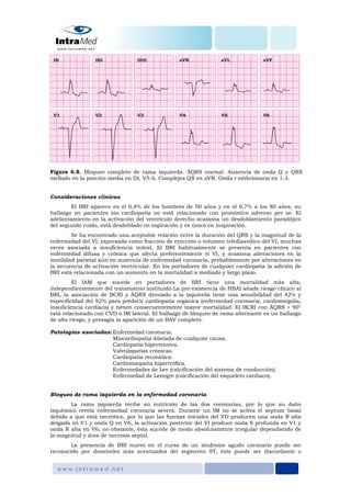 Figura 6.8. Bloqueo completo de rama izquierda. ÂQRS normal. Ausencia de onda Q y QRS
mellado en la porción media en DI, V5-6, Complejos QS en aVR. Onda r embrionaria en 1-3.
Consideraciones clínicas
El BRI aparece en el 0,4% de los hombres de 50 años y en el 6,7% a los 80 años, su
hallazgo en pacientes sin cardiopatía no está relacionado con pronóstico adverso per se. El
adelantamiento en la activación del ventrículo derecho ocasiona un desdoblamiento paradójico
del segundo ruido, está desdoblado en espiración y es único en inspiración.
Se ha encontrado una aceptable relación entre la duración del QRS y la magnitud de la
enfermedad del VI, expresada como fracción de eyección o volumen telediastólico del VI, muchas
veces asociada a insuficiencia mitral. El BRI habitualmente se presenta en pacientes con
enfermedad difusa y crónica que afecta preferentemente el VI, y ocasiona alteraciones en la
motilidad parietal aún en ausencia de enfermedad coronaria, probablemente por alteraciones en
la secuencia de activación ventricular. En los portadores de cualquier cardiopatía la adición de
BRI está relacionada con un aumento en la mortalidad a mediado y largo plazo.
El IAM que sucede en portadores de BRI tiene una mortalidad más alta,
independientemente del tratamiento instituido La pre-existencia de HBAI añade riesgo clínico al
BRI, la asociación de BCRI y ÂQRS desviado a la izquierda tiene una sensibilidad del 42% y
especificidad del 92% para predecir cardiopatía orgánica (enfermedad coronaria, cardiomegalia,
insuficiencia cardiaca) y tienen consecuentemente mayor mortalidad. El BCRI con ÂQRS > 90°
está relacionado con CVD o IM lateral. El hallazgo de bloqueo de rama alternante es un hallazgo
de alto riesgo, y presagia la aparición de un BAV completo.
Patologías asociadas: Enfermedad coronaria.
Miocardiopatía dilatada de cualquier causa.
Cardiopatía hipertensiva.
Valvulopatías crónicas.
Cardiopatía reumática.
Cardiomiopatía hipertrófica.
Enfermedades de Lev (calcificación del sistema de conducción).
Enfermedad de Lenegre (calcificación del esqueleto cardiaco).
Bloqueo de rama izquierda en la enfermedad coronaria
La rama izquierda recibe su nutrición de las dos coronarias, por lo que su daño
isquémico revela enfermedad coronaria severa. Durante un IM no se activa el septum basal
debido a que está necrótico, por lo que las fuerzas iniciales del VD producen una onda R alta
delgada en V1 y onda Q en V6, la activación posterior del VI produce onda S profunda en V1 y
onda R alta en V6; no obstante, ésta sucede de modo absolutamente irregular dependiendo de
la magnitud y área de necrosis septal.
La presencia de BRI nuevo en el curso de un síndrome agudo coronario puede ser
reconocido por desniveles más acentuados del segmento ST, éste puede ser discordante o
 