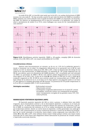 La onda R de aVR se inscribe más tarde que la de aVL y en ambas derivaciones el QRS
termina con una onda R. No hay acuerdo a partir de qué valor de desvío del ÂQRS se considera
HBAI; existiría una cierta relación entre el grado de desvío del AQRS a la izquierda y la duración
del QRS. Se observa un desplazamiento de la zona de transición a la izquierda, con ondas R
altas y persistencia de ondas S en V5-6, estos hallazgos son causa de los “pseudoinfartro de
cara anterior”.
Figura 6.14. Hemibloqueo anterior izquierdo. ÂQRS a -60 grados, complejo QRS de duración
normal, rS en DII, DIII y aVF, con mayor profundidad de S en DIII.
Consideraciones clínicas
Aparece más frecuentemente en varones, se da en un 1,9% de la población general y
tiende a aumentar con la edad. Un diagnóstico diferencial es la asociación con el IM de cara
inferior, en éste se observan ondas Q en DII, DIII y aVF, o bien la disminución del voltaje de las
ondas R en esas derivaciones; el ÂQRS desviado a la izquierda de -30° puede explicarse por un
IM de cara inferior, pero si la desviación del AQRS alcanza a -60°, es probable que esté asociado
un HBAI. La asociación de HBAI e IM de cara inferior podría diagnosticarse si se encuentran
estos signos: R’ en aVR y aVL, el pico de la onda R más tardío en aVR que en aVL y ondas q de
cualquier magnitud en DII. El IM de cara anterior puede ser enmascarado por el HBAI, por el
bajo voltaje de la onda r en V1-2, si se hace un V1 baja aparece una pequeña onda r, si se hace
V1 alta aparece el complejo QS propio del IM anterior. La presencia de CVI puede sospecharse si
la S en DII y el complejos QRS >3 mV en precordiales.
Patologías asociadas: - Enfermedad coronaria.
- Hipertensión arterial
- Cardiopatías congénitas (alteraciones en el canal AV, atresia
tricuspídea, ventrículo común con transposición de grandes
vasos, transposición corregida de los grandes vasos, CIV, CIA
ostium primum).
HEMIBLOQUEO POSTERIOR IZQUIERDO (HBPI)
El fascículo posterior izquierdo del HH es corto y grueso, y además tiene una doble
irrigación –de la descendente anterior y de la descendente posterior, y subyace en el tracto de
entrada del VI-, su daño suele asociarse a lesiones difusas del sistema de conducción y del VI.
En el HBPI, la conducción del estímulo en el VI se realiza inicialmente (los primeros 0,02 seg)
por el fascículo anterior, dando un vector hacia la izquierda y arriba generando una onda q en
DII, DIII y aVF; posteriormente se activa el fascículo posterior a través de las fibras de Purkinje,
que da un vector orientado a la derecha, hacia abajo y atrás originando una onda S en DI, y
ondas R en DII, DIII y aVF, estas últimas tienen mayor voltaje porque activan una mayor masa
muscular del VI. Para hacer este diagnóstico deben descartarse la presencia de corazón vertical
e hipertrofia ventricular derecha.
 