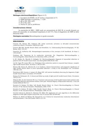 Hallazgos electrocardiográficos: (Figura 6.17)
1. Los típicos de BCRD, con R’ ancha y empastada en V1.
2. ÂQRS desviado a la derecha, > +120°.
3. qR en DII, DIII y aVF.
4. rS en DI y aVL.
5- Patrón S1, Q3 en periféricas.
Consideraciones clínicas
La asociación de BRD + HBPI suele ser premonitoria de BAV III, si sucede durante un
infarto de miocardio, la mortalidad hospitalaria es del 71%. Para el diagnóstico de HBPI se debe
descartar HVD.
Patologías asociadas: Miocardiopatías en grado avanzado.
BIBLIOGRAFIA
Cannom DS, Wyman MG, Goldreyer BN. Initial ventricular activation in left-sided intraventricular
conduction defects. Circulation 1980;62:621-626.
Conover MB (Ed). Bundle Branch Block and Hemiblock. In: Understanding Electrocardiography. 8th Ed.
Mosby, 2003. 316-331.
Demoulin JC, Kulbertus HE. Histopatological examination of the concepts of left hemiblock. Br Heart J
1972;34:807-
Friedman HH. Trastornos de la conducción ventricular. En: Diagnóstico Electrocardiográfico y
Vectocardiográfico. Salvat Editores S.A, Barcelona 1898. p 163-208
Li SF, Walden PL, Marcilla O, Gallagher EJ. Electrocardiographic diagnosis of myocardial infarction in
patients with left bundle branch block. Ann Emerg Med 2000;36:561-565.
Lev M, Unger PN, Lesser ME, et al. Pathology of the conduction system in acquired heart disease: complete
right bundle branch block. Am Heart J 1961;61:593-
Moreno AM, Tomas JG, Alberola AG, et al. Incidence, clinical characteristics, and prognostic significance of
right bundle branch block in acute myocardial infarction: a study in the thrombolytic era. Circulation
1997;96:1139-
Rosenbaum MB, Yesuron J, Lazzari JO, Elizari MV. Left anterior hemiblock obscuring the diagnosis of right
bundle branch block. Circulation 1973:48:298-
Rotman M, Tiebwasser JH. A clinical and follow-up study of right and left bundle branch block. Circulation
1975;51:477-
Shlipack MG, Go AS, Frederick PD et al. Treatment and outcomes of left bundle-branch block patients with
myocardial infarction who presents without chest pain. National Registry of Myocardial Infarction. J Am Coll
Cardiol 2000;36:706-712.
Surawicz B, Knilans TK (Eds). Left Bundle Branch Block. In: Chou’s Electrocardiograhpy in Clinical
Practice. 6th Ed. Elsevier Saunders. Philadelphia, 2008, 75-94.
Surawicz B, Knilans TK (Eds.) Right Bundle Branch Block. In: Chou’s Electrocardiography in Clinical
Practice. 6th Ed. Saunders Elsevier, Philadelphia, 2008, 95-107.
Vereckei A,Durai G, Szénási G, Altemose GT, Miller JM. Application of a new algorithm in the differential
diagnosis of wide QRS complex tachycardia. Eur H Journal 2007;28:589-600.
Willems JL, Robles de Medina OE, Bernard R, et al. Criteria for intraventricular conduction disturbances
and preexcitation. J Am Coll Cardiol 1985;5:112-118.
 