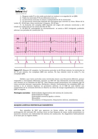 1.- Ninguna onda P (u otra onda auricular) se conduce o es seguida de un QRS.
2.- Todos los intervalos P-R son diferentes entre sí.
2.- La frecuencia auricular es mayor e independiente de la ventricular.
3.- La frecuencia ventricular depende del marcapaso que controle su ritmo. Ritmo de la
unión AV, 40-60 lpm; ritmo ventricular o hispano, 30-40 lpm.
4.- la duración del complejo QRS depende del origen del estímulo ventricular y del
estado de conducción de las ramas del Haz de His.
5.- El BAV III° anterógrado no necesariamente se asocia a BAV retrógrado, pudiendo
alternar con periodos de conducción VA.
Figura 9.7. Bloqueo AV completo. La frecuencia auricular es de 90 por minuto, la ventricular es
de 35 por minuto, los complejos QRS son anchos. No hay relación entre la onda P y los
complejos QRS.
Debido a que tanto aurículas como ventrículos tienen una frecuencia diferente, porque
responden a marcapasos diferentes, durante un BAV III° hay disociación aurículo-ventricular,
este término no es sinónimo de BAV III°. Este bloqueo puede presentarse con cualquier tipo de
ritmo auricular (sinusal, taquicardia, fibrilación o aleteo). Generalmente los complejos QRS son
anchos y en sí mismos implican un pronóstico adverso; en el IAM de cara inferior con
compromiso de la coronaria derecha se observa un ritmo de escape suprahisiano y el complejo
QRS es angosto.
Patologías asociadas: Enfermedades degenerativas del sistema de conducción.
Enfermedad de Chagas.
Enfermedad coronaria aguda o crónica.
Miocarditis.
Secundaria a b-bloqueantes, bloqueantes cálcicos, amiodarona.
BLOQUEO AURÍCULO-VENTRICULAR PAROXÍSTICO
Son episodios de BAV que aparecen en forma súbita, no están precedidos de
prolongación del intervalo PR, muchas veces no hay bloqueos de rama; suelen presentarse en
pacientes ancianos con enfermedad del sistema de conducción. Su diagnóstico habitualmente
se lo hace por un registro Holter.
 