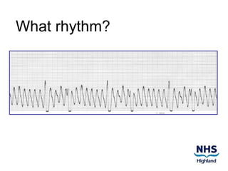 ECG Jeopardy | POTX