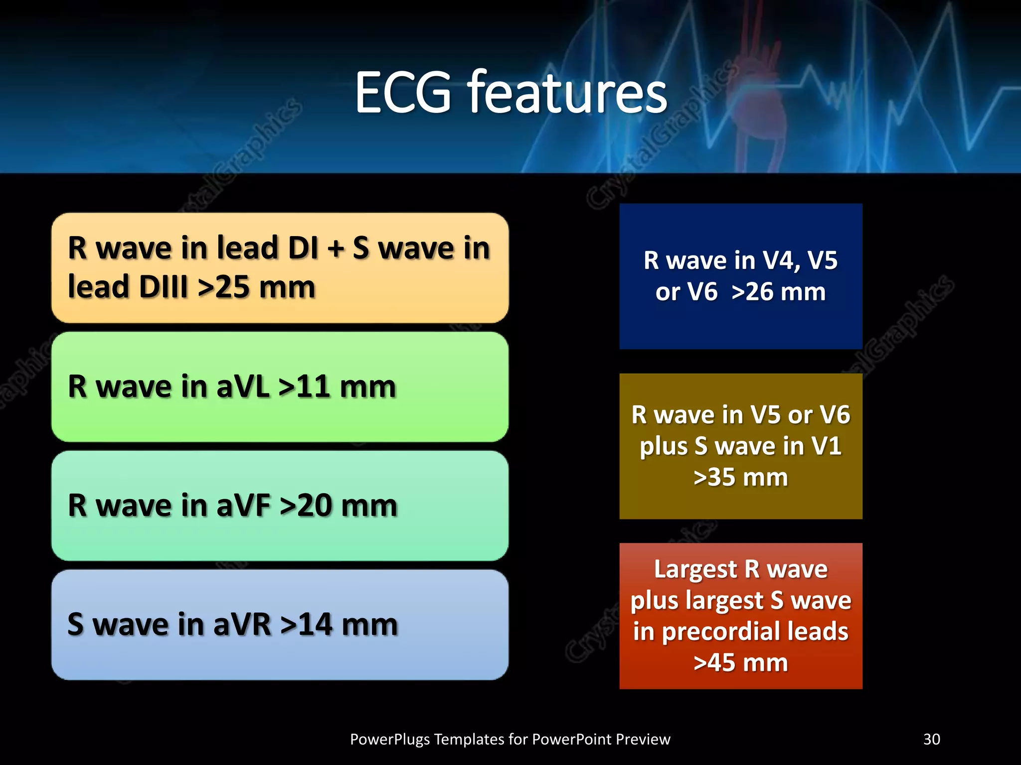 ECG features
R wave in lead DI + S wave in
lead DIII >25 mm
R wave in aVL >11 mm
R wave in aVF >20 mm
S wave in aVR >14 mm
R wave in V4, V5
or V6 >26 mm
R wave in V5 or V6
plus S wave in V1
>35 mm
Largest R wave
plus largest S wave
in precordial leads
>45 mm
PowerPlugs Templates for PowerPoint Preview 30
 