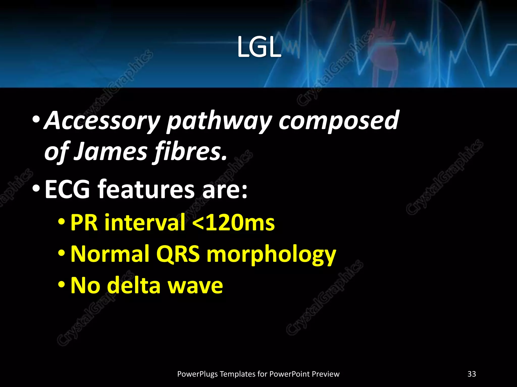 LGL
•Accessory pathway composed
of James fibres.
•ECG features are:
•PR interval <120ms
•Normal QRS morphology
•No delta wave
PowerPlugs Templates for PowerPoint Preview 33
 