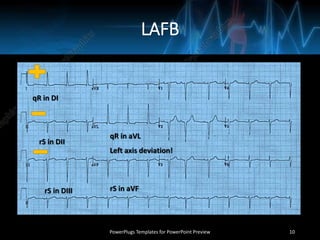 LAFB
PowerPlugs Templates for PowerPoint Preview 10
Left axis deviation!
qR in DI
rS in DII
rS in DIII
qR in aVL
rS in aVF
 