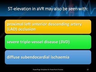 ST-elevation in aVR may also be seen with:
proximal left anterior descending artery
(LAD) occlusion
severe triple-vessel disease (3VD)
diffuse subendocardial ischaemia
PowerPlugs Templates for PowerPoint Preview 19
 