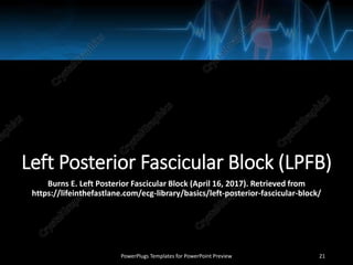 Left Posterior Fascicular Block (LPFB)
Burns E. Left Posterior Fascicular Block (April 16, 2017). Retrieved from
https://lifeinthefastlane.com/ecg-library/basics/left-posterior-fascicular-block/
PowerPlugs Templates for PowerPoint Preview 21
 