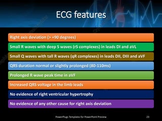 ECG features
Right axis deviation (> +90 degrees)
Small R waves with deep S waves (rS complexes) in leads DI and aVL
Small Q waves with tall R waves (qR complexes) in leads DII, DIII and aVF
QRS duration normal or slightly prolonged (80-110ms)
Prolonged R wave peak time in aVF
Increased QRS voltage in the limb leads
No evidence of right ventricular hypertrophy
No evidence of any other cause for right axis deviation
PowerPlugs Templates for PowerPoint Preview 23
 