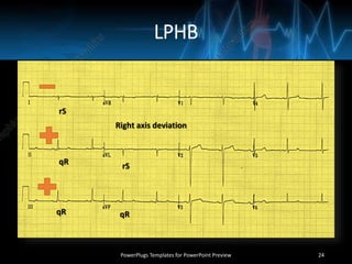 LPHB
PowerPlugs Templates for PowerPoint Preview 24
rS
rSqR
qR qR
Right axis deviation
 
