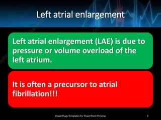 Left atrial enlargement
Left atrial enlargement (LAE) is due to
pressure or volume overload of the
left atrium.
It is often a precursor to atrial
fibrillation!!!
PowerPlugs Templates for PowerPoint Preview 3
 