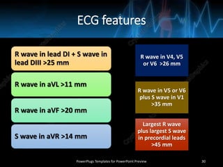 ECG features
R wave in lead DI + S wave in
lead DIII >25 mm
R wave in aVL >11 mm
R wave in aVF >20 mm
S wave in aVR >14 mm
R wave in V4, V5
or V6 >26 mm
R wave in V5 or V6
plus S wave in V1
>35 mm
Largest R wave
plus largest S wave
in precordial leads
>45 mm
PowerPlugs Templates for PowerPoint Preview 30
 