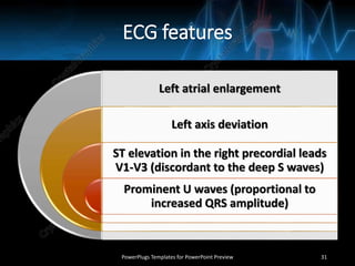 ECG features
Left atrial enlargement
Left axis deviation
ST elevation in the right precordial leads
V1-V3 (discordant to the deep S waves)
Prominent U waves (proportional to
increased QRS amplitude)
PowerPlugs Templates for PowerPoint Preview 31
 