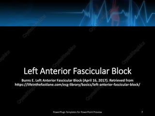Left Anterior Fascicular Block
Burns E. Left Anterior Fascicular Block (April 16, 2017). Retrieved from
https://lifeinthefastlane.com/ecg-library/basics/left-anterior-fascicular-block/
PowerPlugs Templates for PowerPoint Preview 7
 