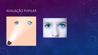 AVALIAÇÃO PUPILAR
 