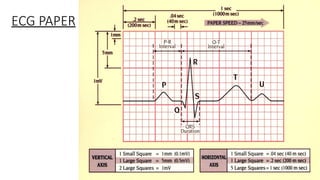 Comprehensive Guide to ECG Monitoring and Cardiac Rhythm Interpretation ...