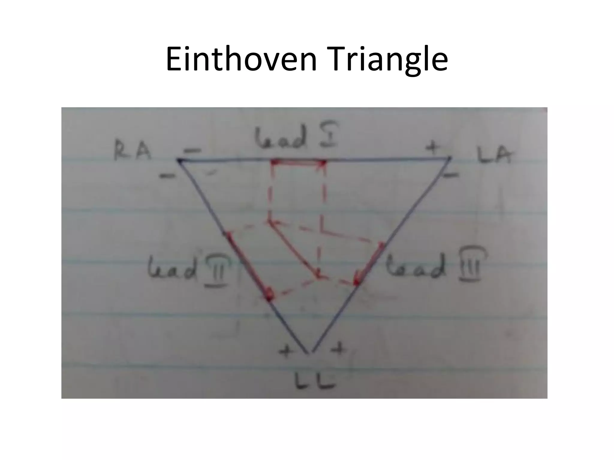 Einthoven Triangle
 