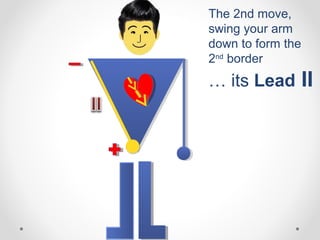 The 2nd move,
swing your arm
down to form the
2nd
border
… its Lead II
 