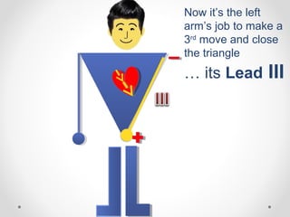 Now it’s the left
arm’s job to make a
3rd
move and close
the triangle
… its Lead III
 
